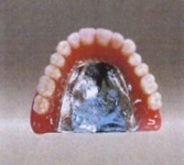 金属床義歯.jpg
